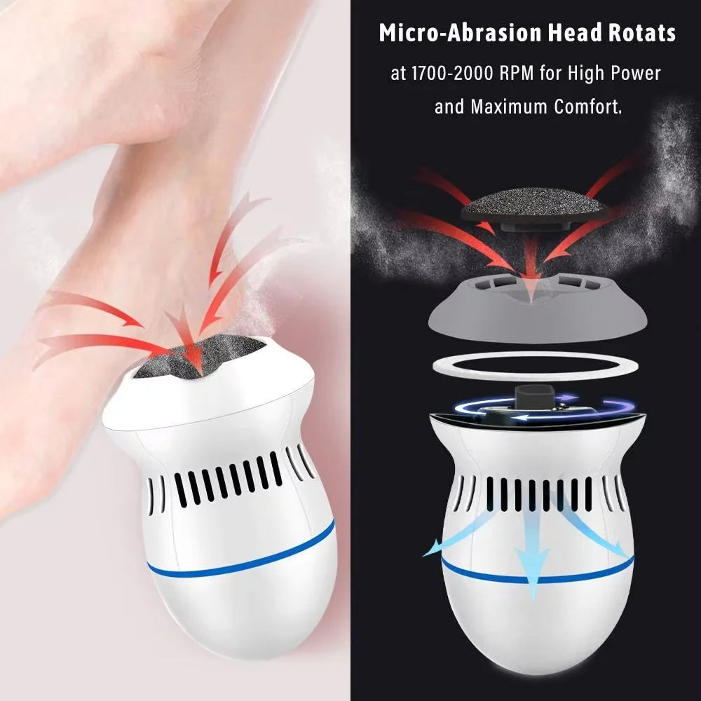 Rechargeable electric callus remover — product photo 3
